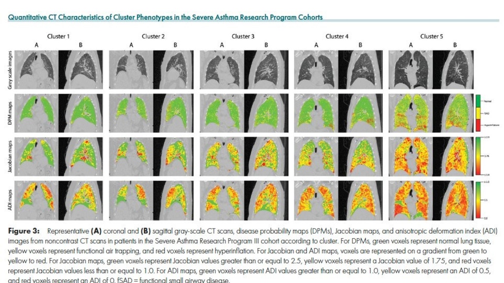 Display of asthma cluster phenotypes